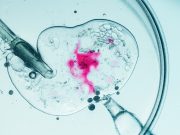 Modelling and simulations of Biological processes – Hands on workshop