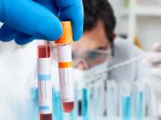 Advanced Immunology Experiment (Hands-on workshop with mouse model)