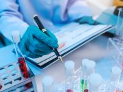 Basic Immunology Experiment (Hands on workshop)